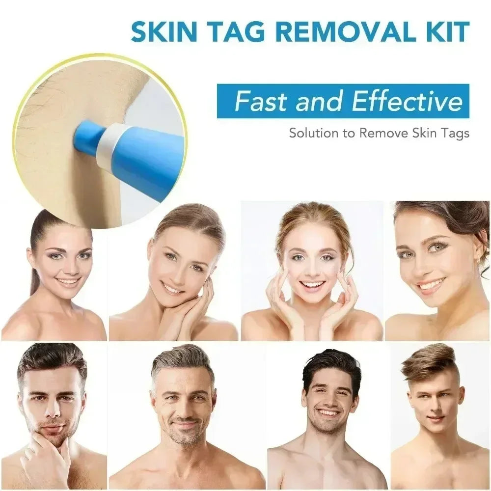 2-in-1 Skin Tag & Wart Removal Kit